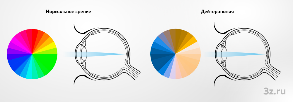 Цветное зрение у человека. Строение глаза дальтоника. Строение глаза при дальтонизме. Восприятие цвета глазом схема.